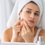 Skin Concerns