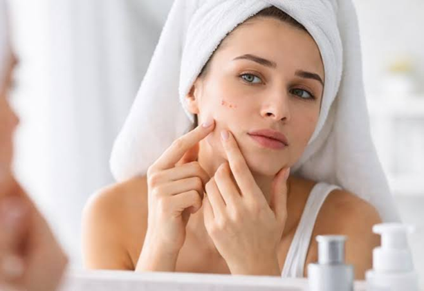 Skin Concerns